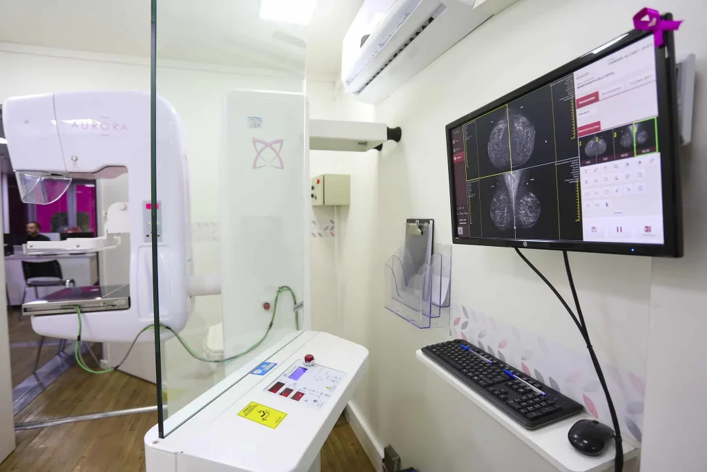 Carreta da Mamografia oferece exames gratuitos em Ilha Solteira